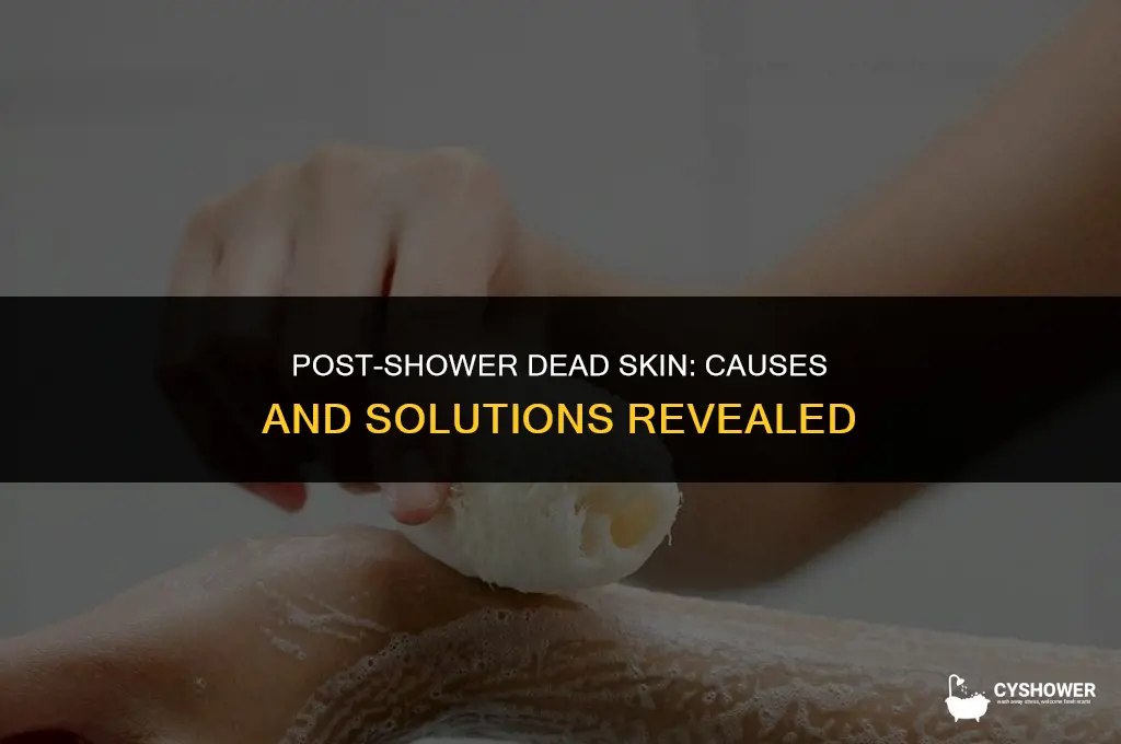 why do i have so much dead skin after shower