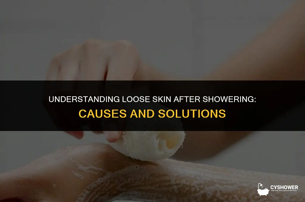 why do i have so much loose skin after shower