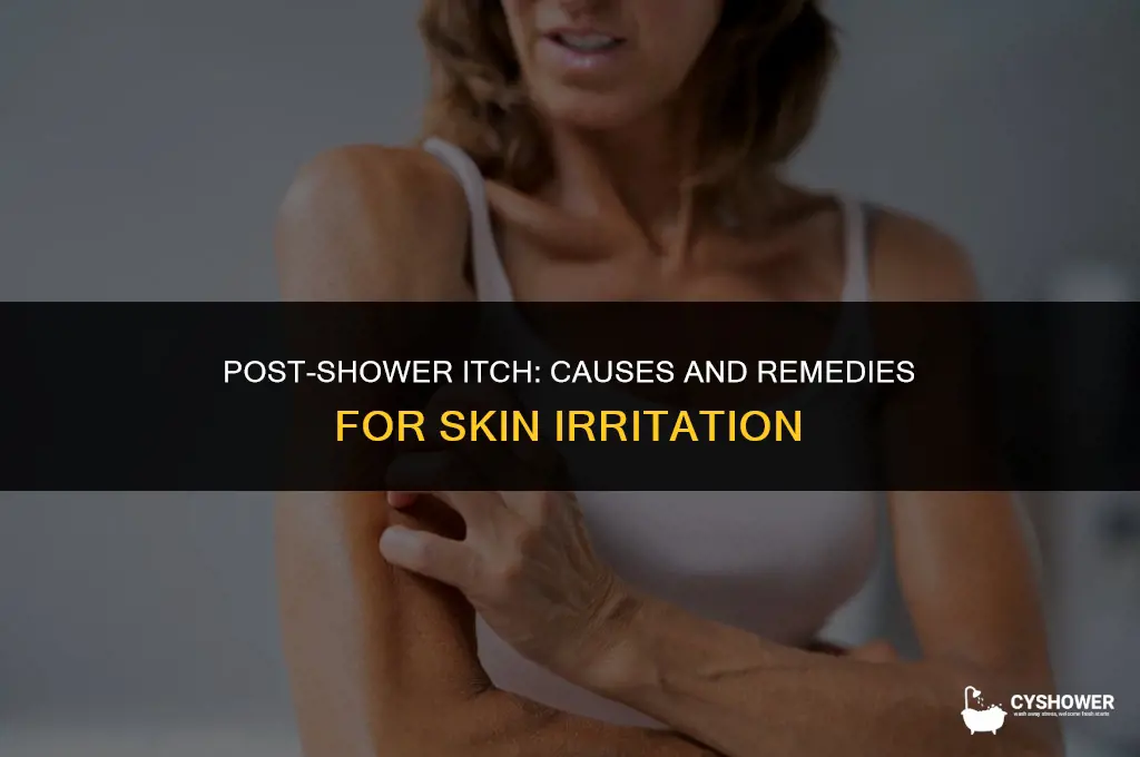 why do i itch so much after a shower