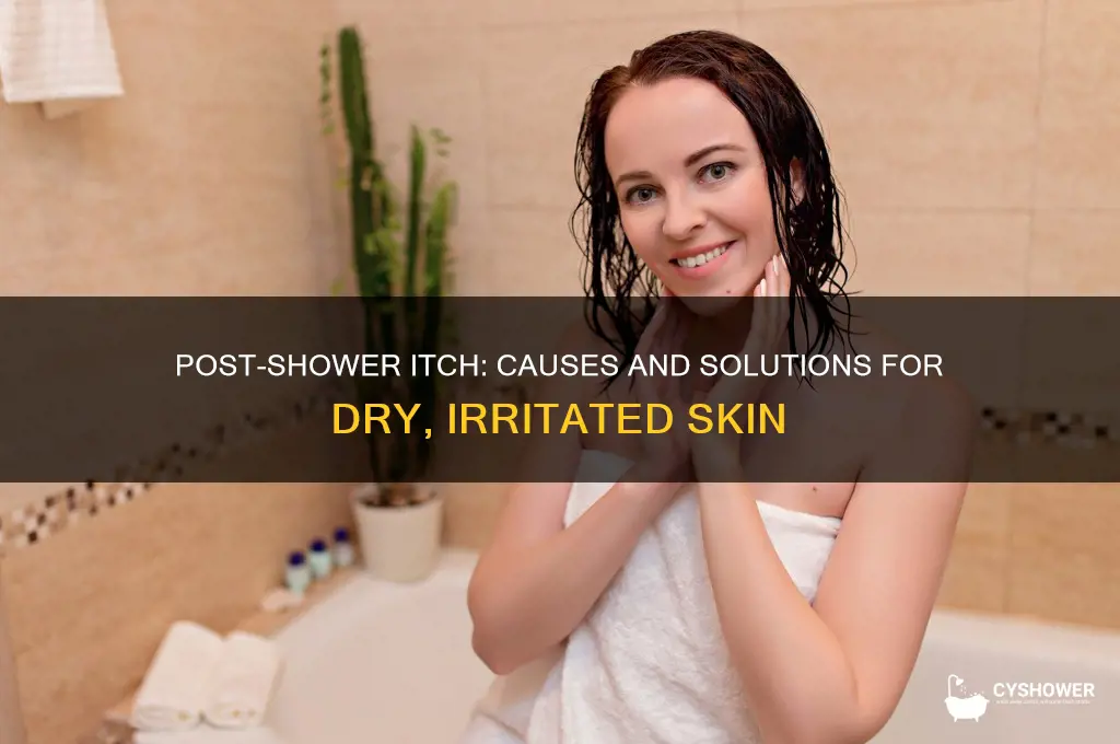 why do i itch when i get out the shower