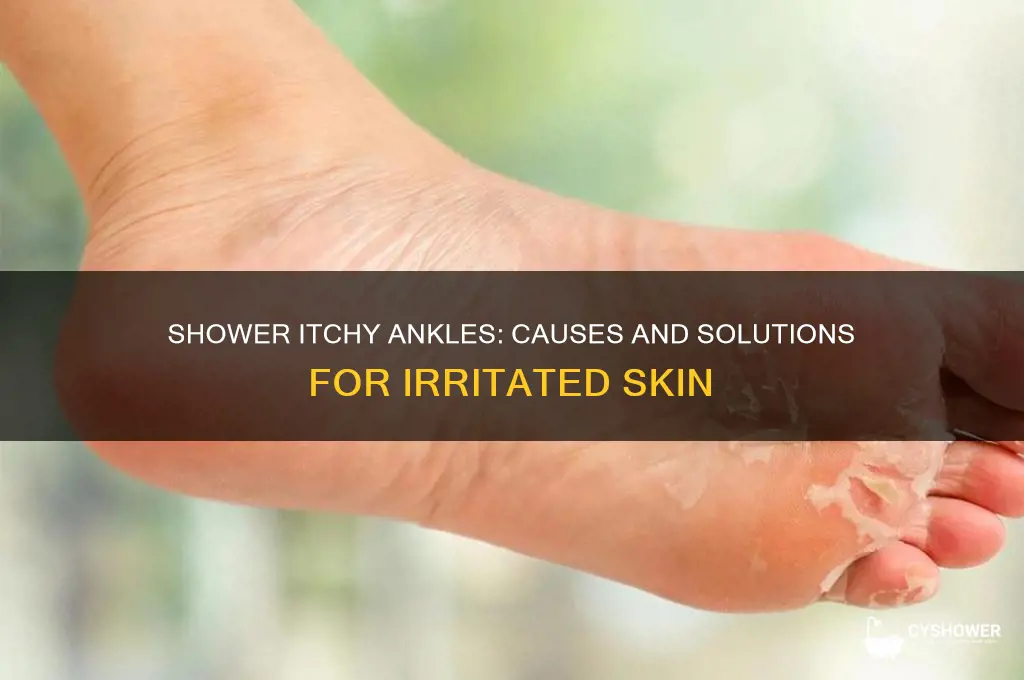 why do my ankles itch when i take a shower