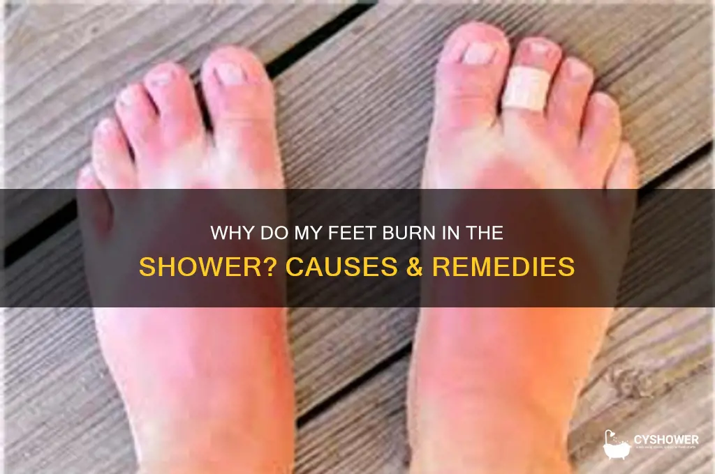 why do my feet burn when i take a shower