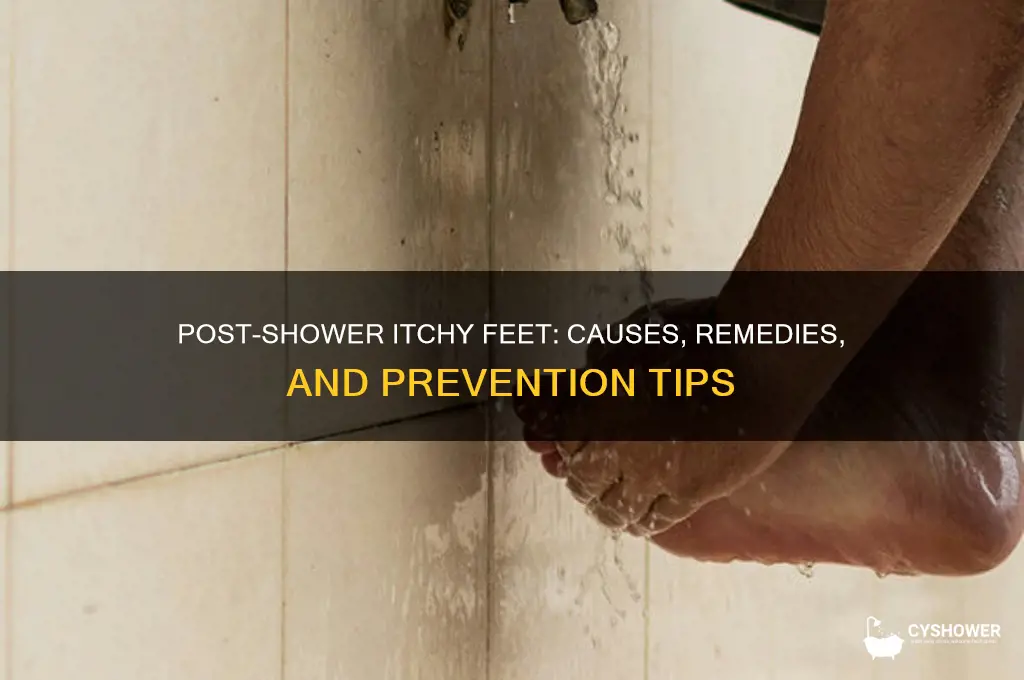 why do my feet get itchy after a shower