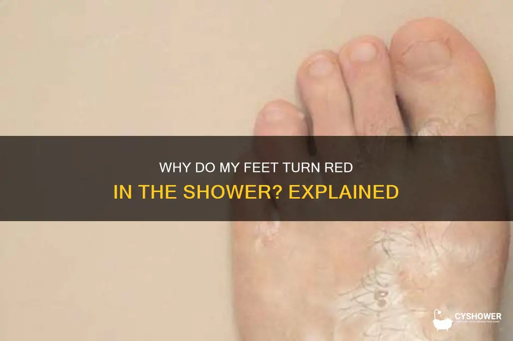 why do my feet get red in the shower