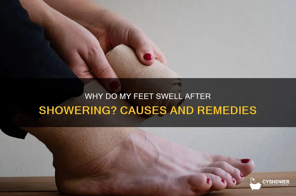why do my feet get swollen after shower