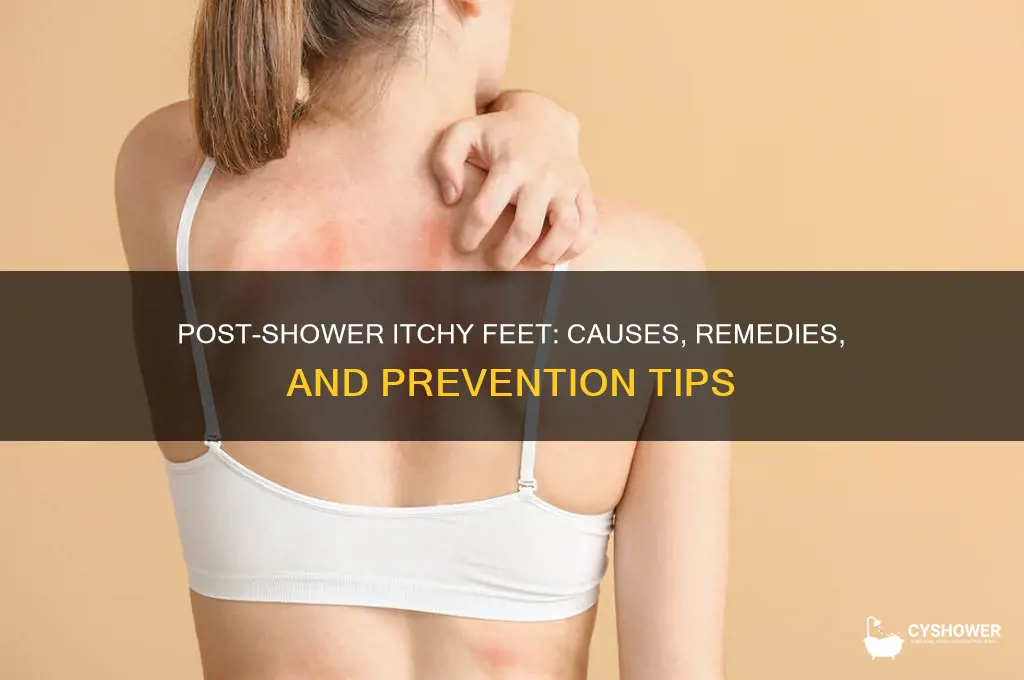 why do my feet itch after i take a shower