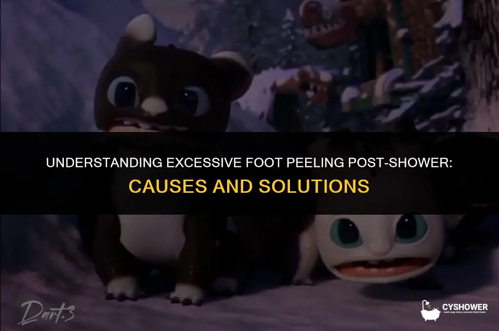 why do my feet peel so much after shower