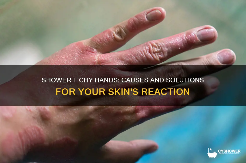 why do my hands itch when i take a shower
