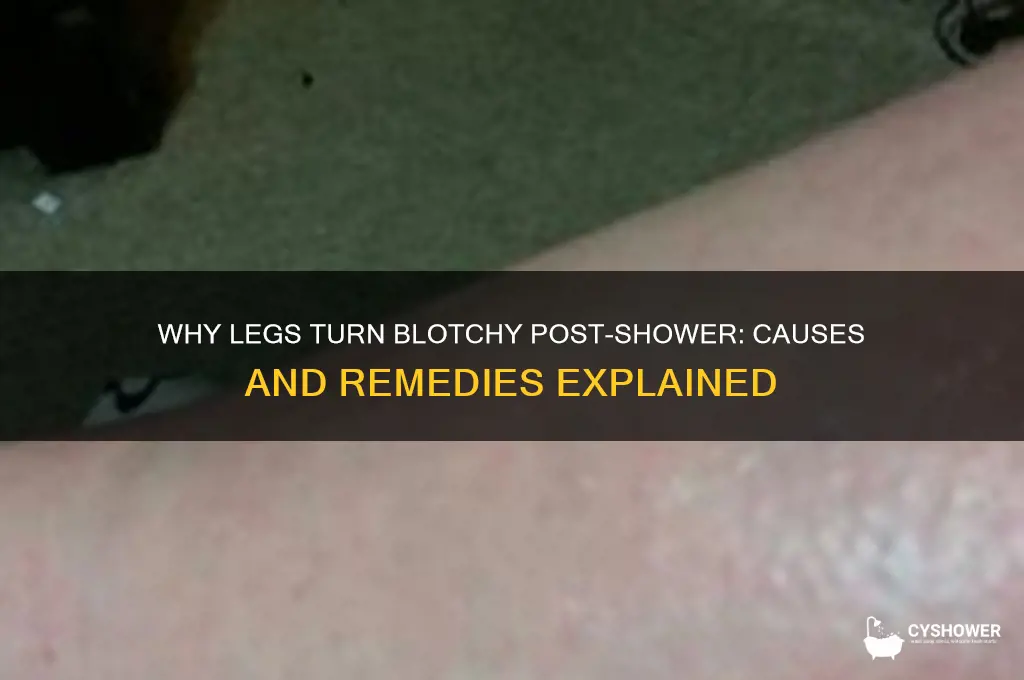 why do my legs get blotchy after a shower