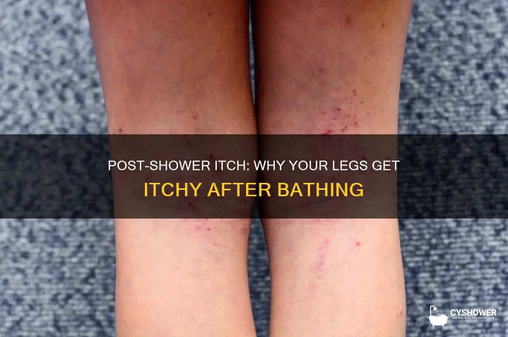 why do my legs get itchy after a shower