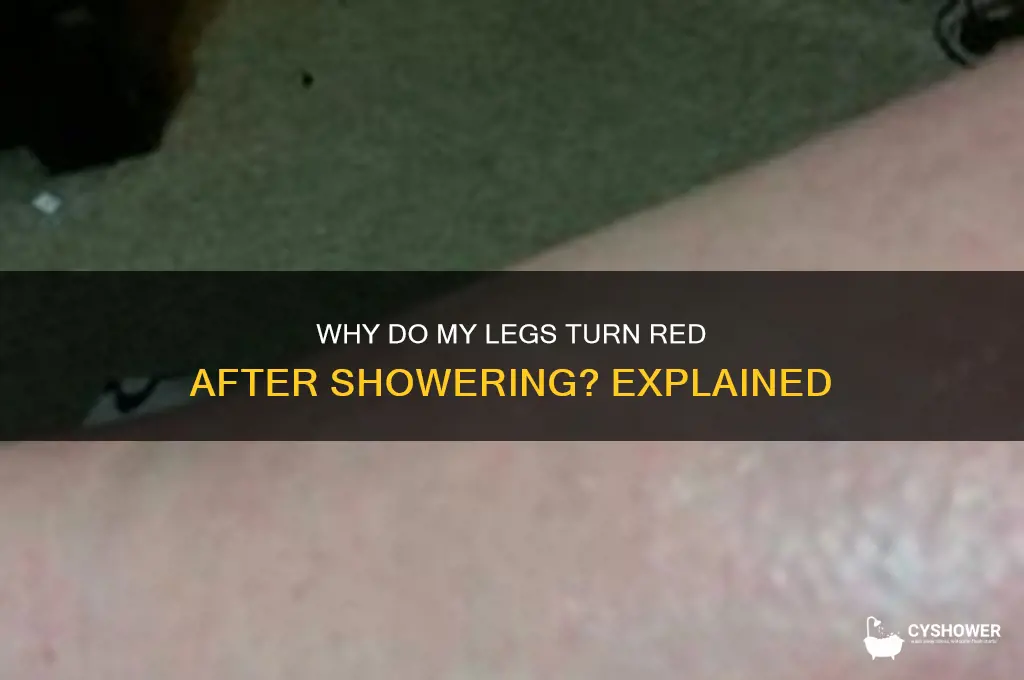 why do my legs get red after a shower