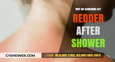 Why Sunburns Intensify Post-Shower: Unraveling the Redness Mystery