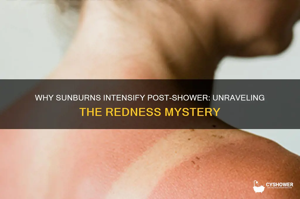why do sunburns get redder after shower