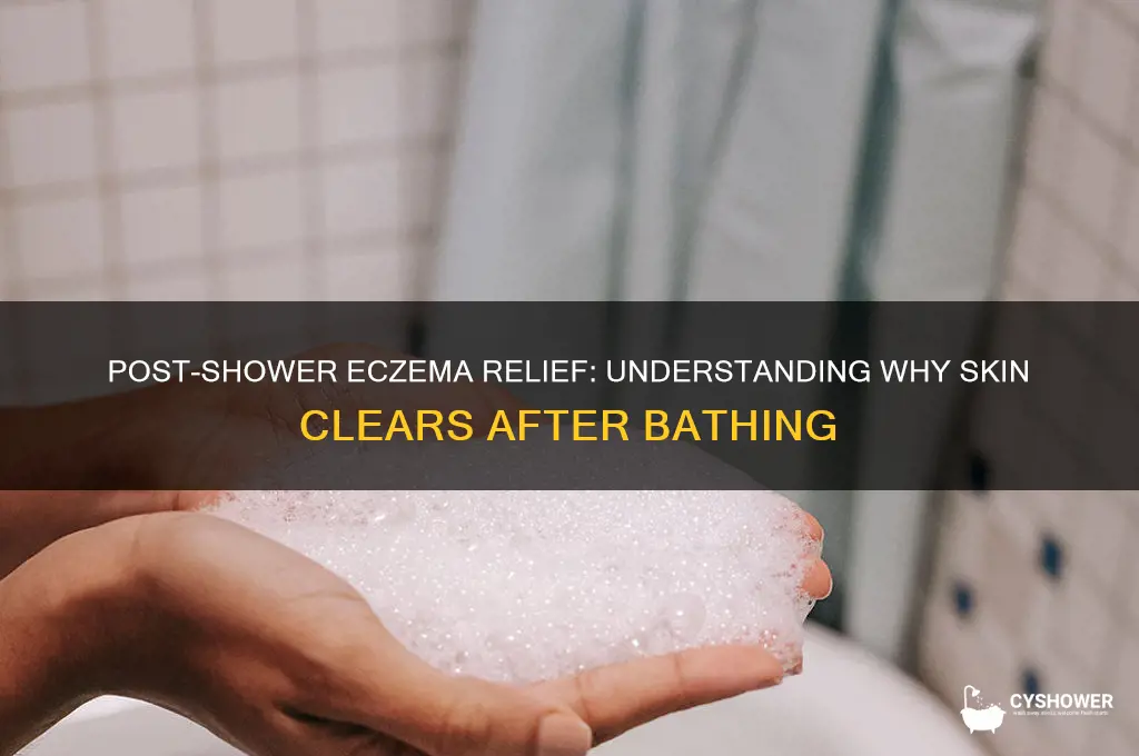why does eczema get rid after shower