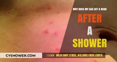 Post-Shower Butt Rash: Causes, Prevention, and Soothing Solutions Explained