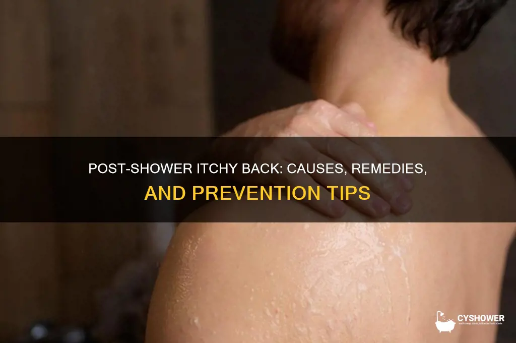 why does my back get itchy after a shower