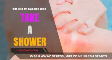 Post-Shower Back Itch: Causes and Remedies Explained
