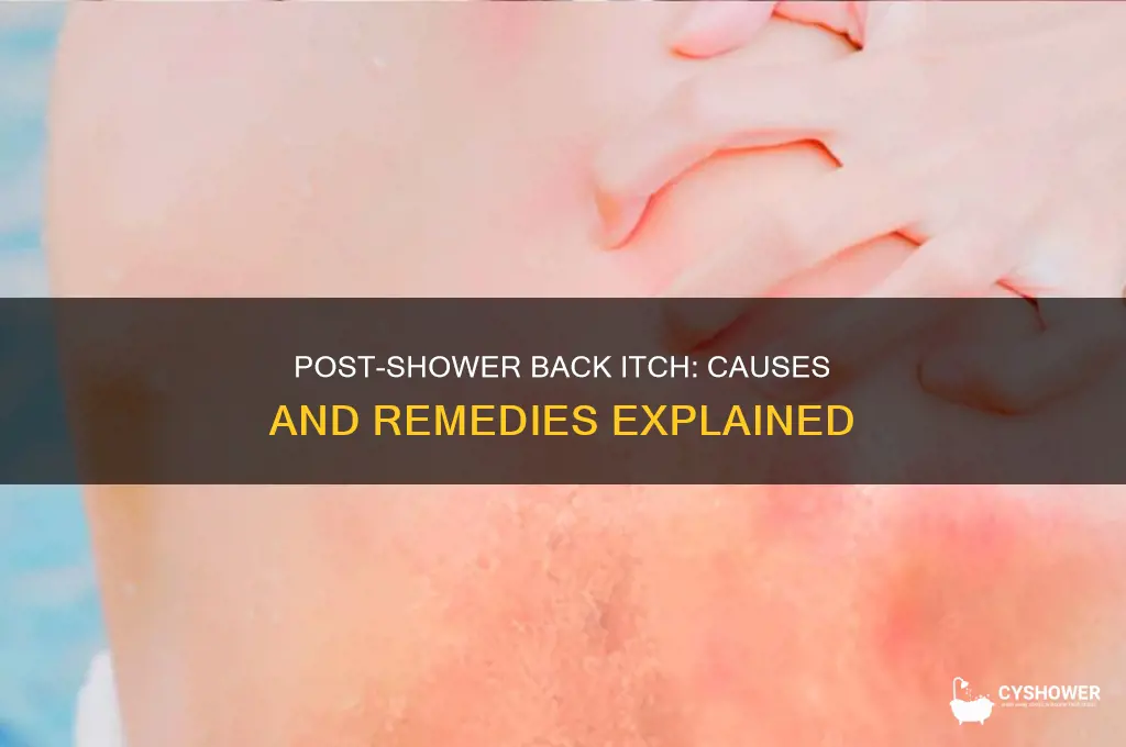 why does my back itch after i take a shower