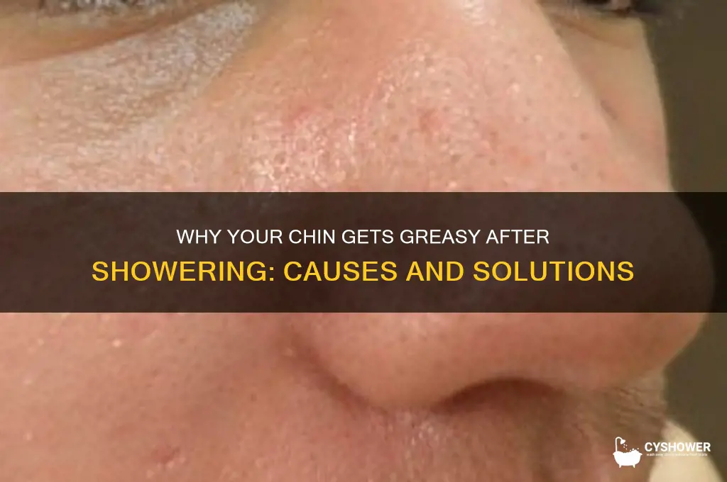 why does my chin get greasy after shower