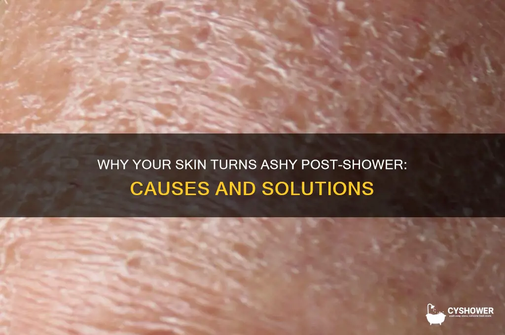 why does my face get ashy after a shower