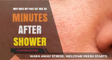 Post-Shower Redness: Understanding Why Your Face Flushes After 30 Minutes