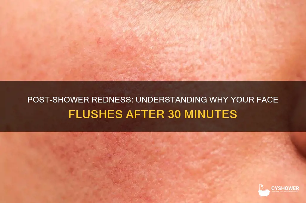 why does my face get red 30 minutes after shower