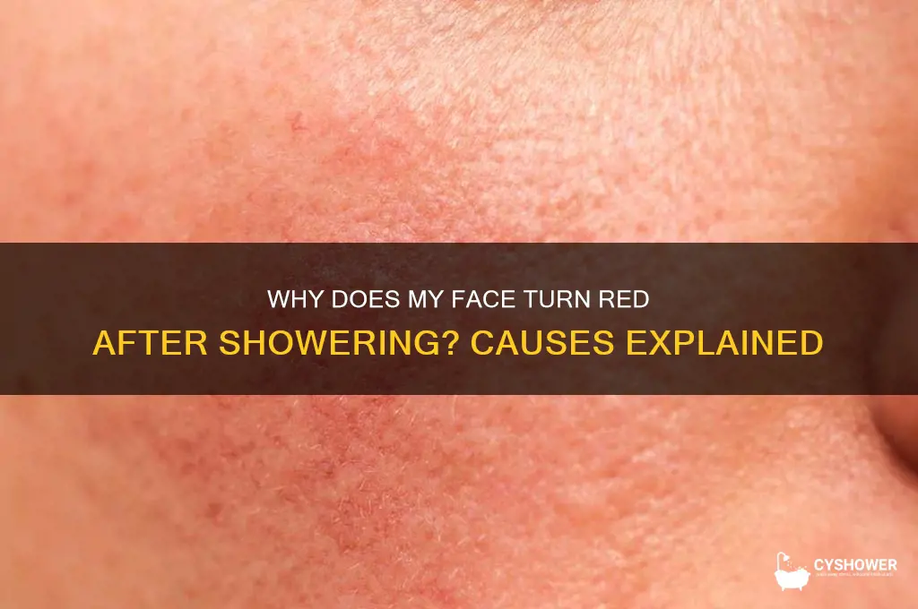 why does my face get red after i shower
