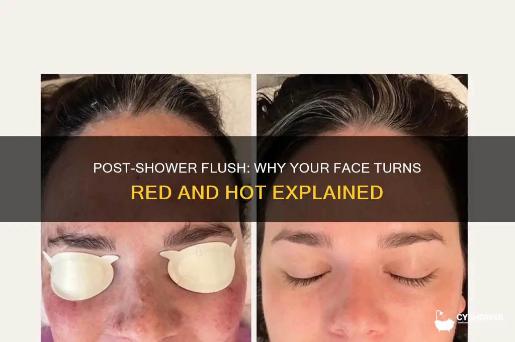 why does my face get red and hot after shower