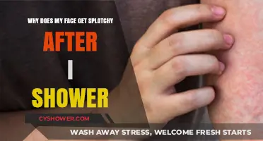 Post-Shower Splotchy Skin: Causes and Solutions for Redness