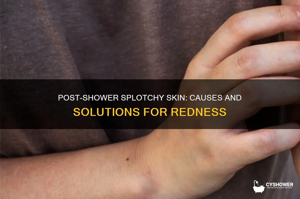 why does my face get splotchy after i shower