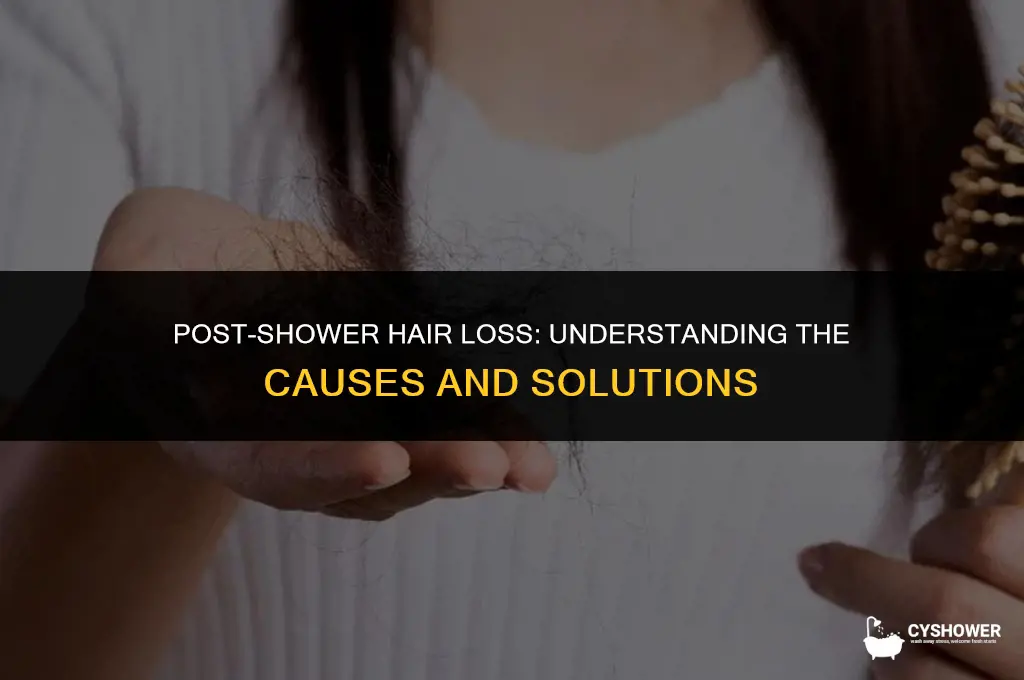 why does my hair fall out so much after shower