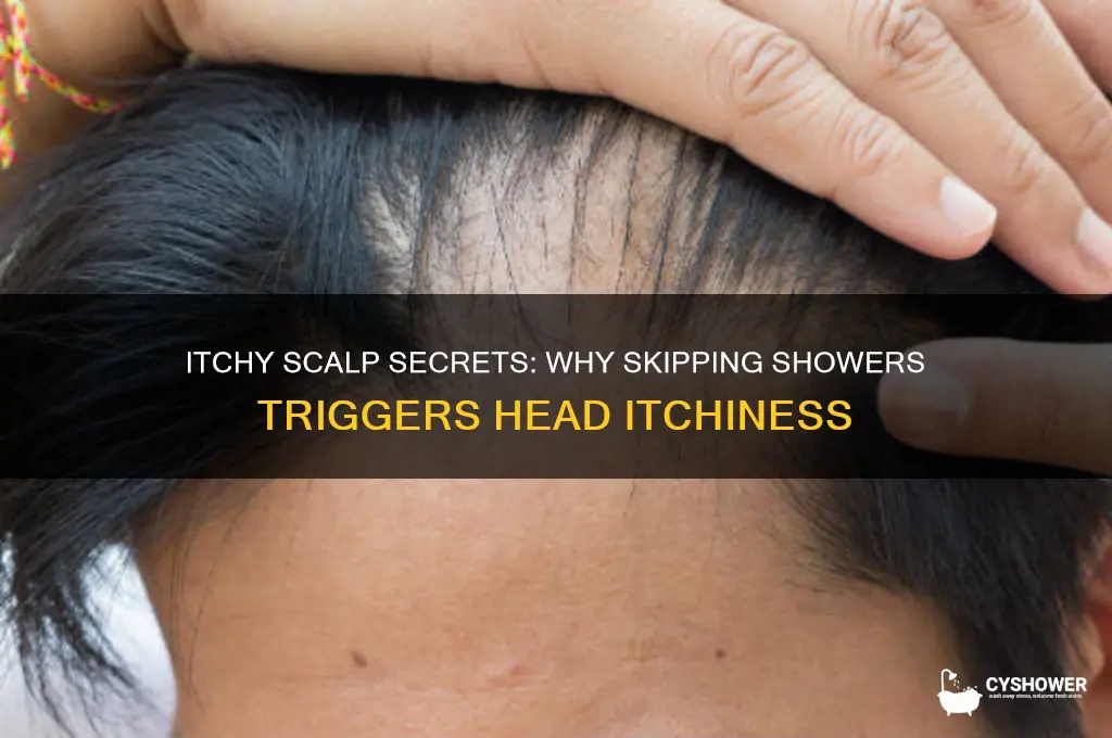 why does my head get itchy when i don