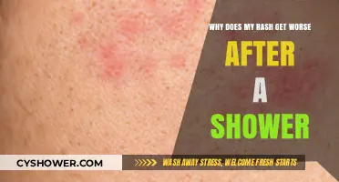 Post-Shower Rash Flare-Ups: Causes and Soothing Solutions Explained