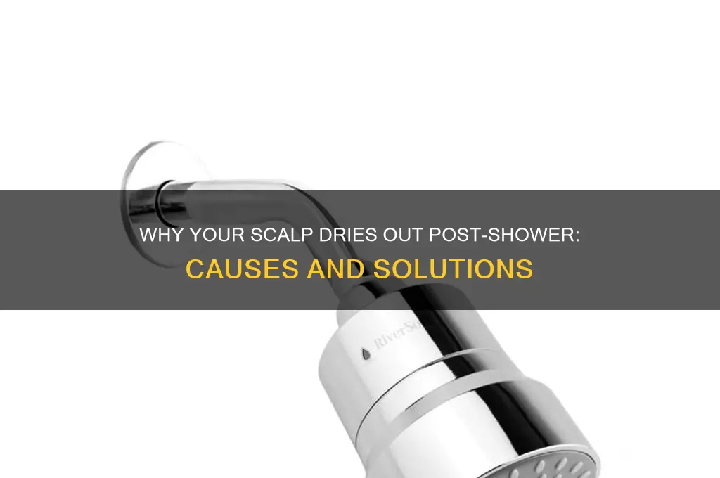 why does my scalp get dry after a shower