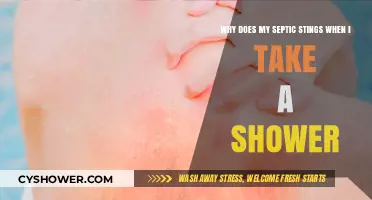 Shower Stings? Uncovering the Septic System-Skin Irritation Connection
