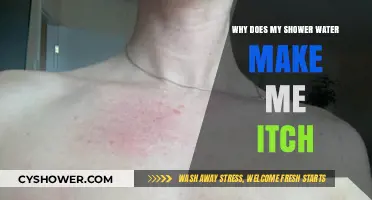 Shower Water Itch: Causes and Solutions for Skin Irritation