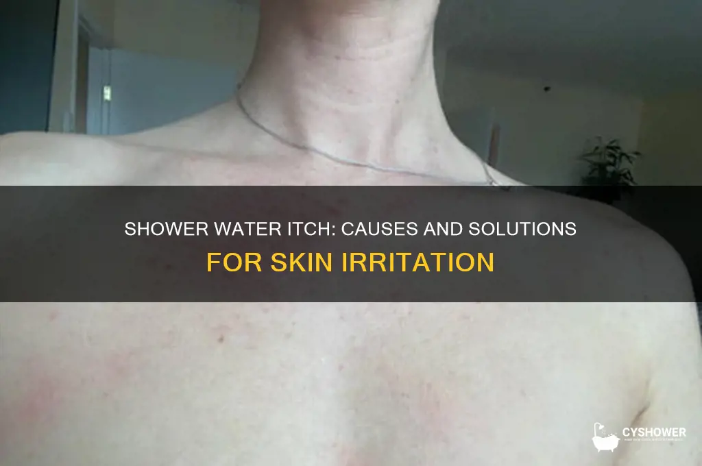 why does my shower water make me itch
