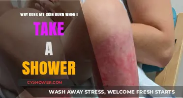 Shower Skin Burning: Causes, Remedies, and Prevention Tips