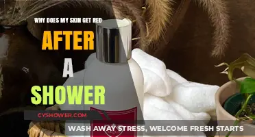Why Does My Skin Turn Red After Showering? Causes and Solutions