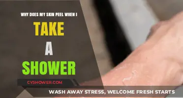 Shower Skin Peeling: Causes and Solutions for Healthy Skin