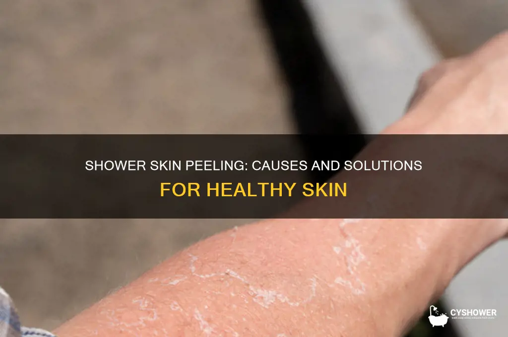 why does my skin peel when i take a shower