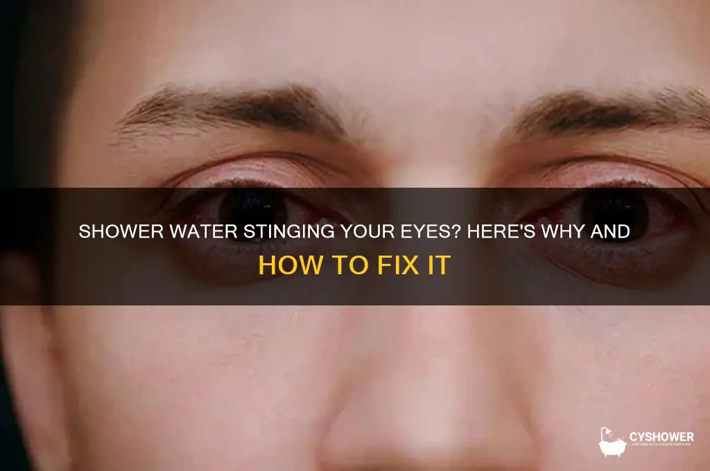 why does shower water hurt my eyes