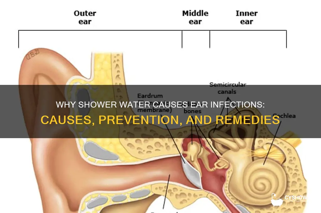 why does shower water infect my ears