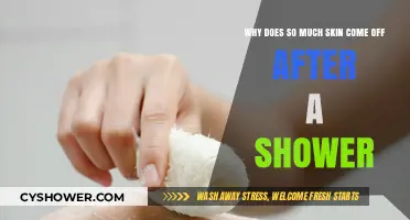 Unveiling the Mystery: Why Showers Cause Excessive Skin Shedding