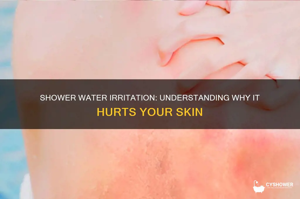 why does the shower water hurt my skin