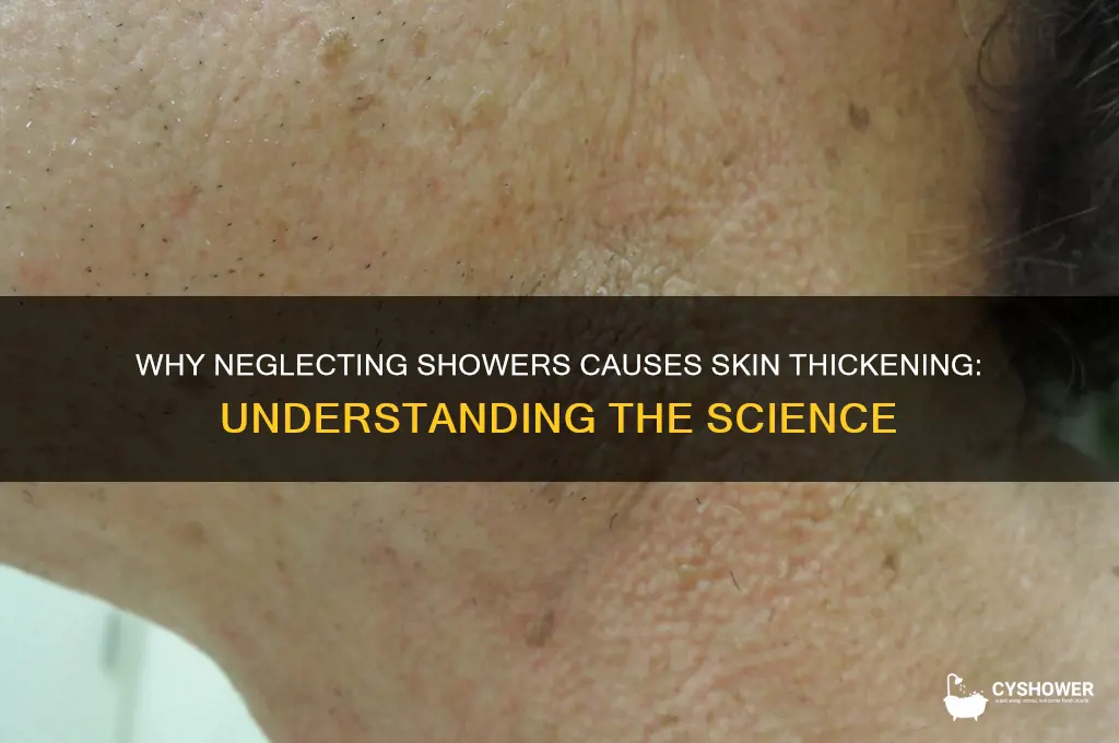 why does your skin get thick when you dont shower
