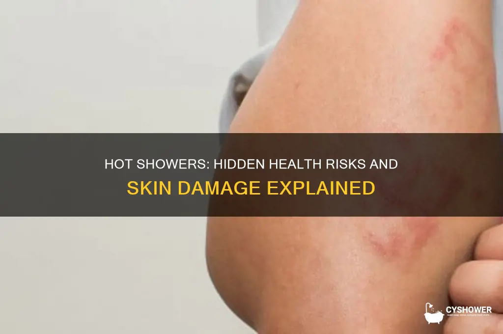 why is it bad to take a hot shower