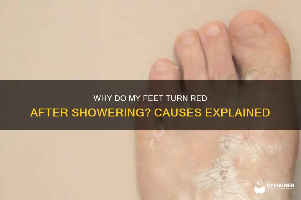why my feet turn red after i take a shower