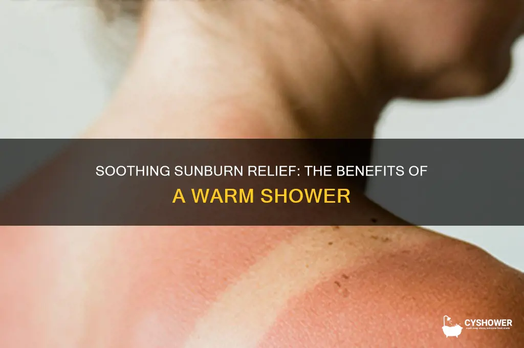 why take a warm shower after sunburn