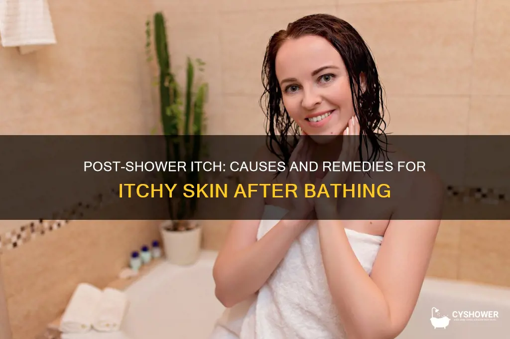 why when i get out the shower my body itches